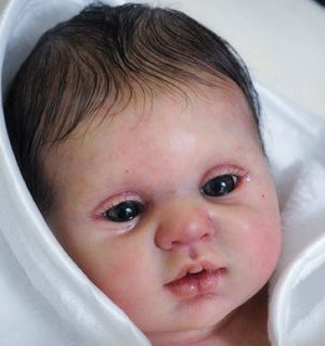 Blinkin  Girl (Donna Rubert) KIT DE SEGUNDA